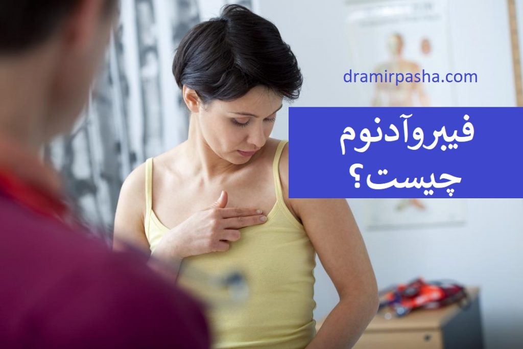 پرسش و پاسخ در مورد فیبروآدنوم