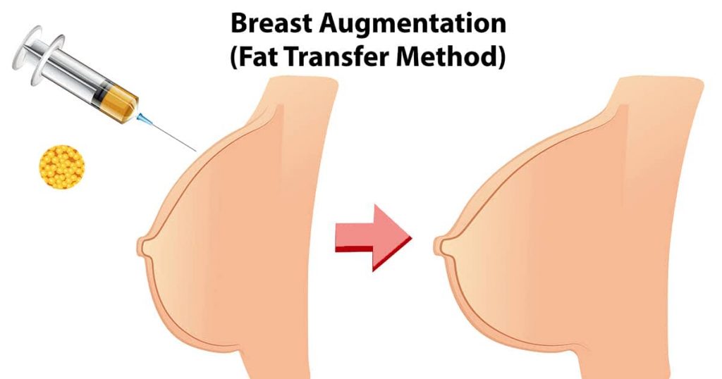 جراحی زیبایی پستان