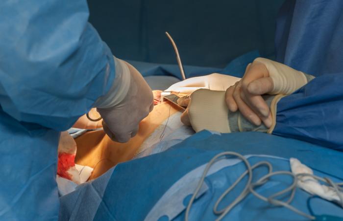 بهترین دکتر جراح سینه در تهران