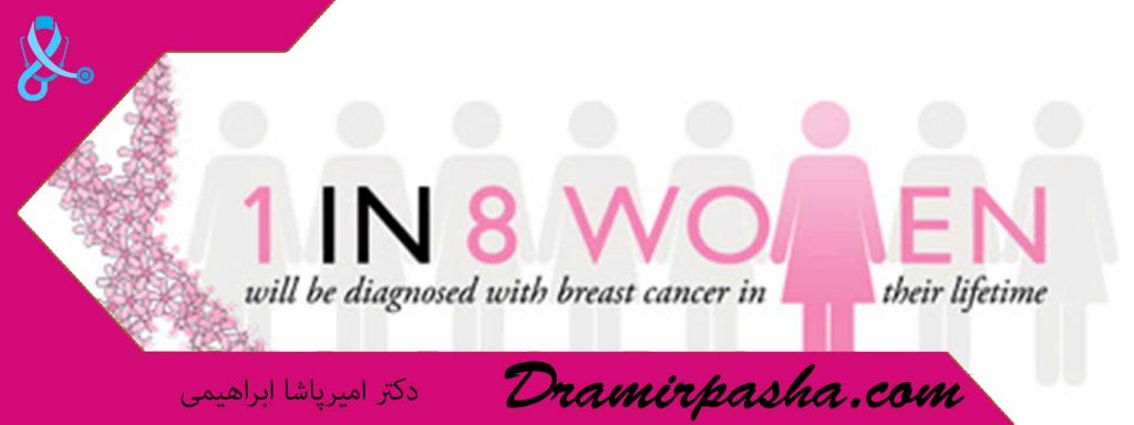 درمان سرطان سینه گرید 3