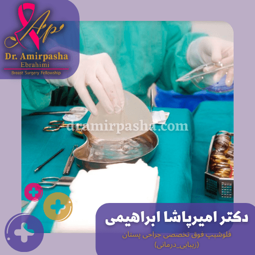 بهترین جراح سینه در تهران