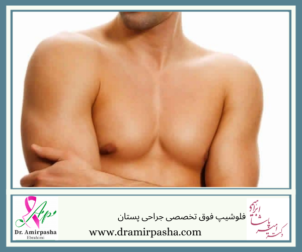 عمل کوچک کردن سینه در مردان