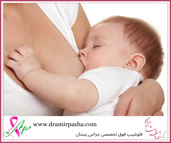 بارداری و شیردهی با پروتز سینه 