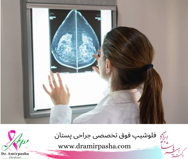 روش های درمانی سرطان پستان 
