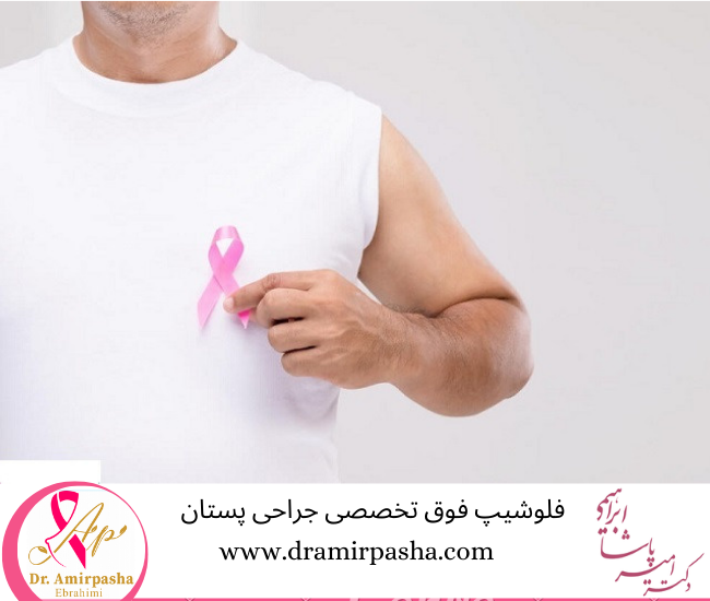 سرطان سینه در مردان 