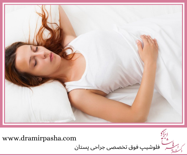 طرز خوابیدن بعد از عمل ماموپلاستی چگونه است؟