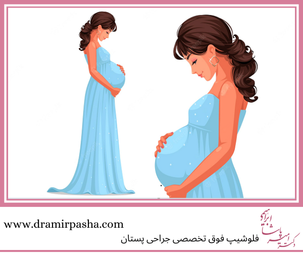 انجام ماموپلاستی در دوران بارداری و شیردهی