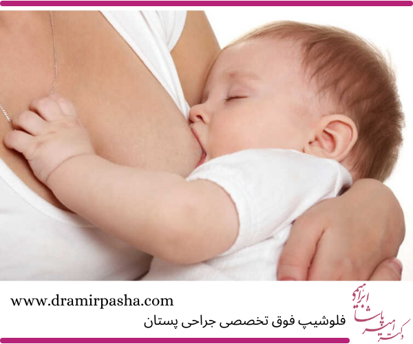ماموپلاستی کاهشی در دوران بارداری و شیردهی 
