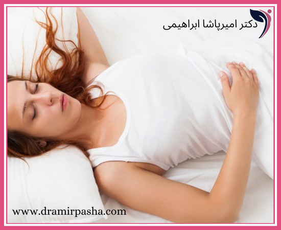 طرز خوابیدن بعد از عمل پروتز سینه