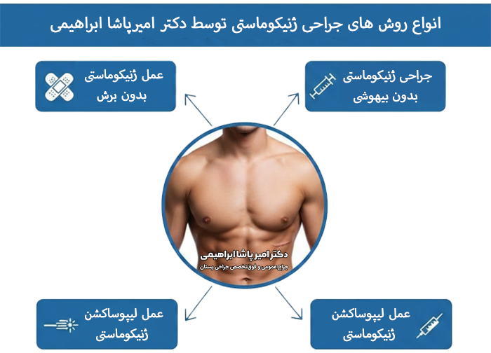 انواع جراحی ژنیکوماستی