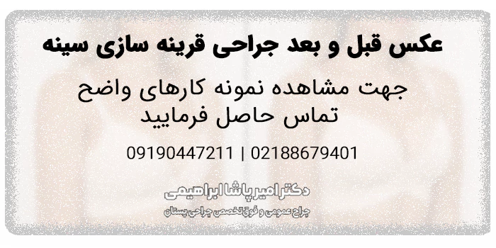 عکس قبل و بعد جراحی قرینه سازی سینه