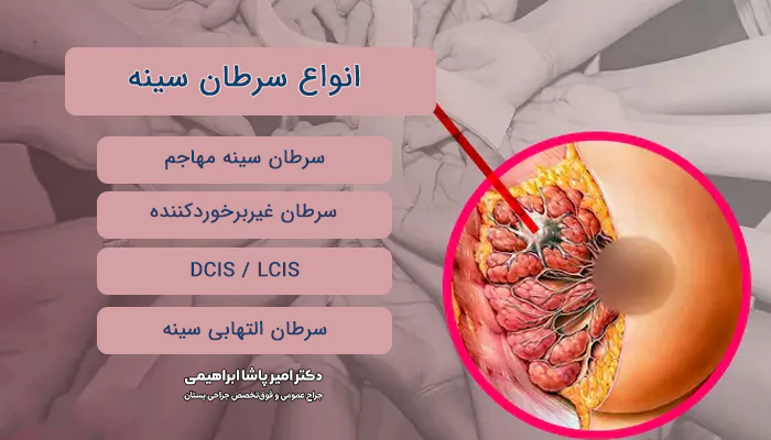 انواع سرطان سینه