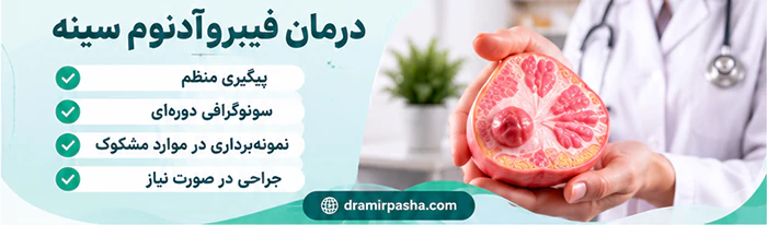 درمان فیبرو آدنوم سینه