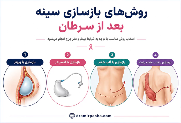 روش های باز سازی سینه