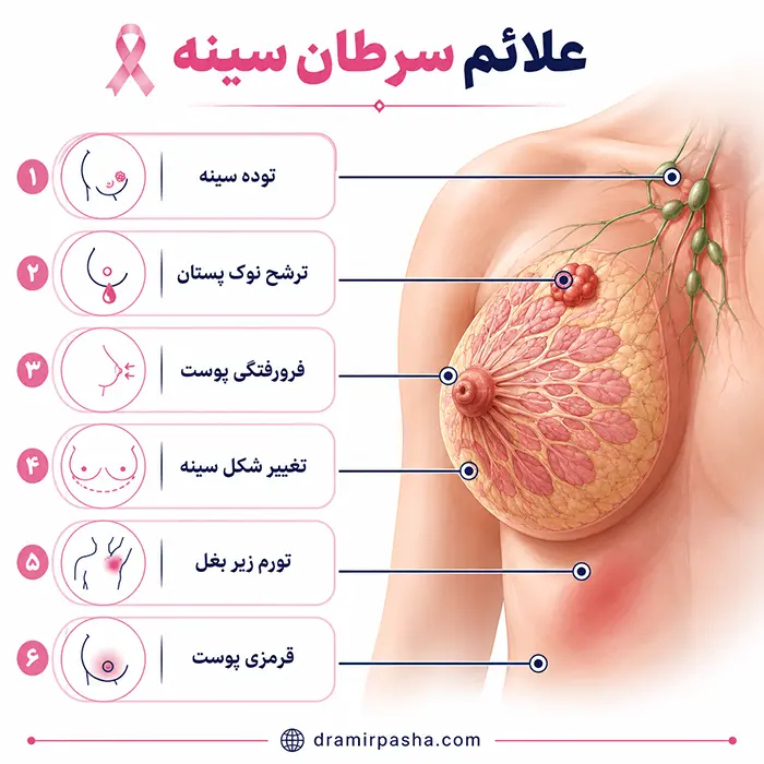 علائم سرطان سینه