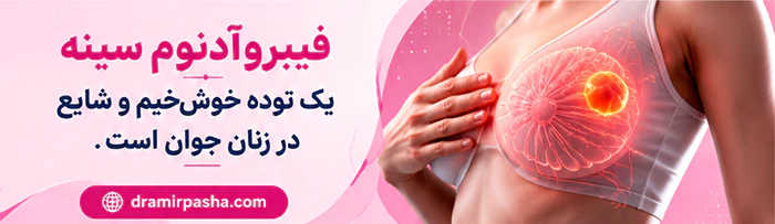 فیبرو آدنوم سینه