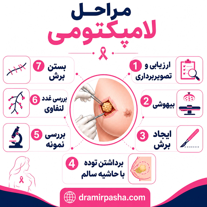 مراحل جراحی لامپکتومی