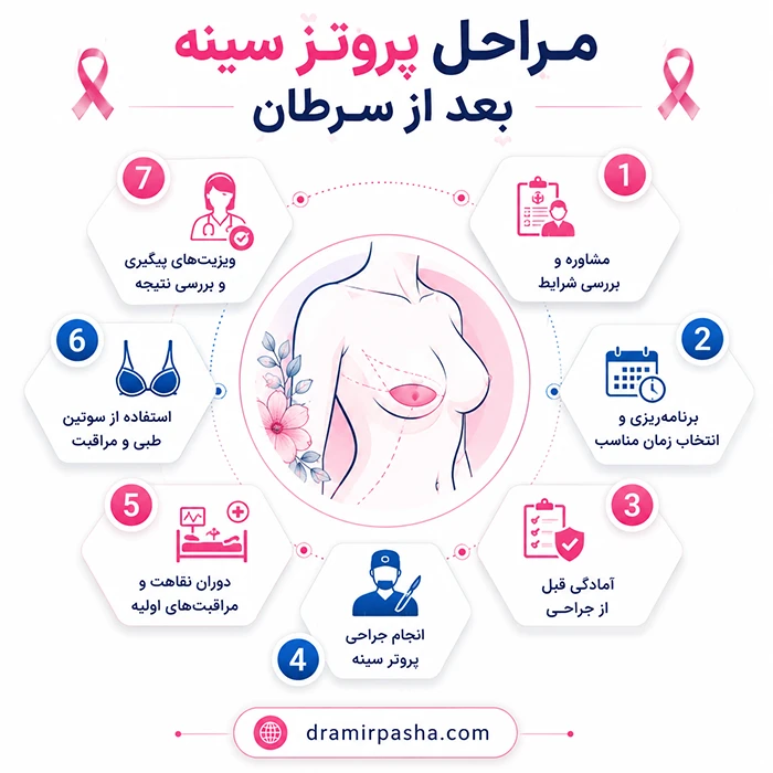 مراحل پروتز سینه بعد از سرطان
