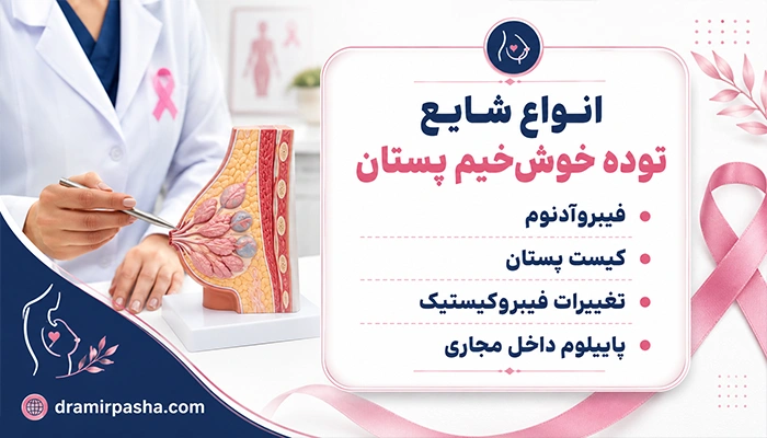 انواع توده خوش خیم پستان