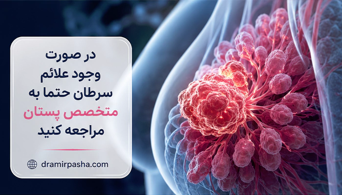 سرطان سینه 3 گانه منفی