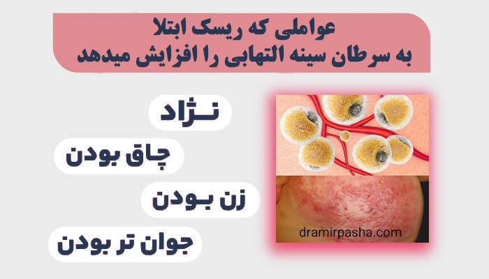عوامل خطر سرطان سینه التهابی