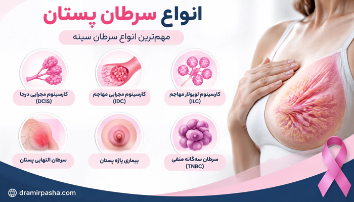 اینفوگرافیک از انواع سرطان پستان