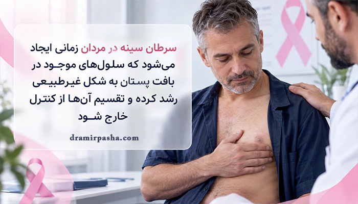 نمای مفهومی از ایجاد سرطان پستان در مردان و رشد غیرطبیعی سلولها