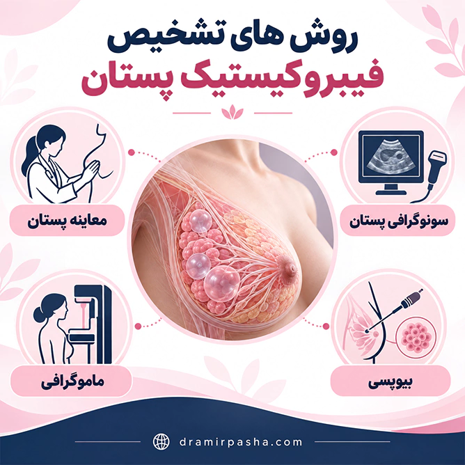 روشهای تشخیص فیبروکیستیک پستان با معاینه، سونوگرافی، ماموگرافی و بیوپسی