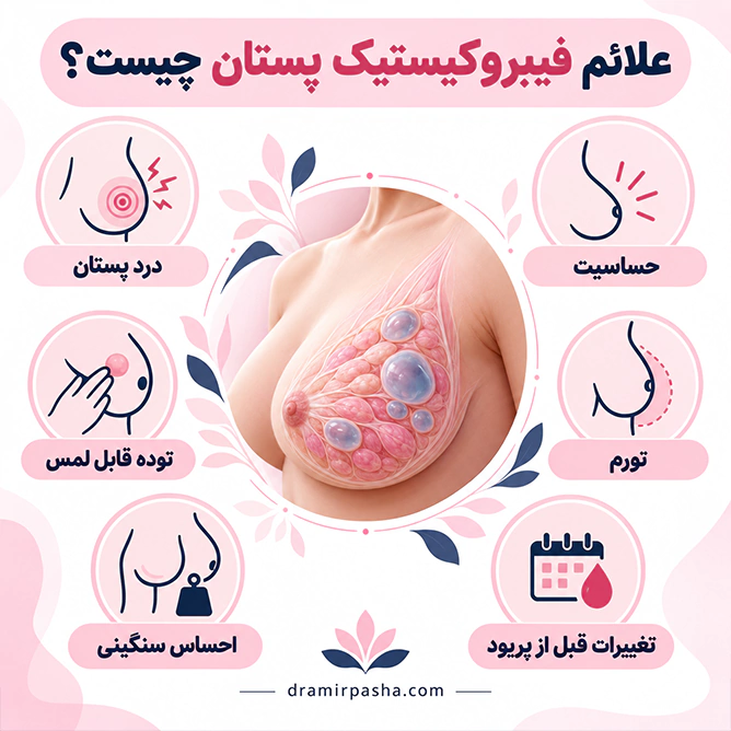 علائم فیبروکیستیک پستان شامل درد، حساسیت، توده قابل لمس، تورم و احساس سنگینی سینه
