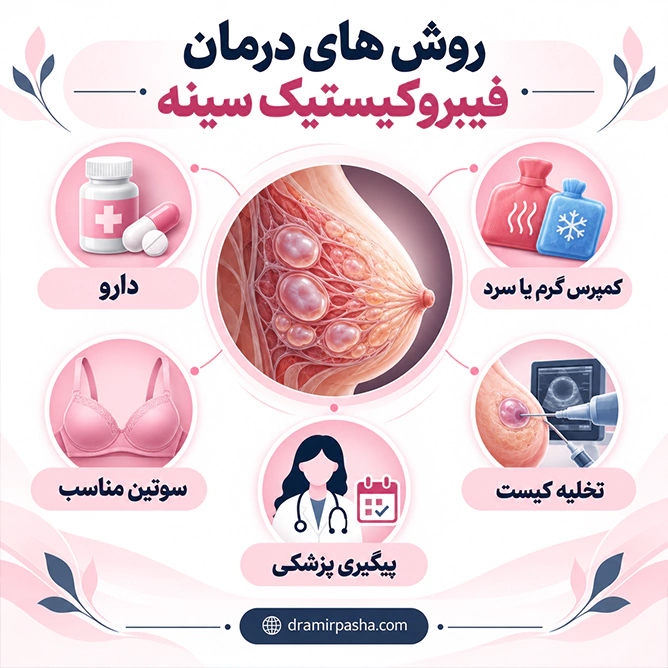 روشهای درمان فیبروکیستیک سینه شامل دارو، کمپرس، سوتین مناسب، تخلیه کیست و پیگیری پزشکی