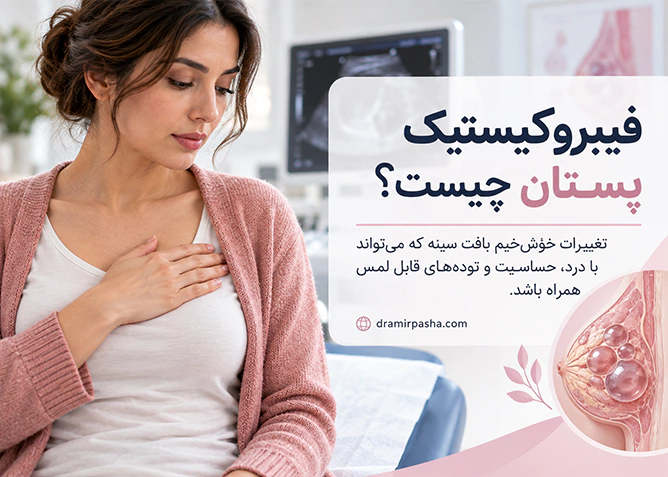 فیبروکیستیک پستان و تغییرات خوش خیم بافت سینه همراه با درد و توده قابل لمس